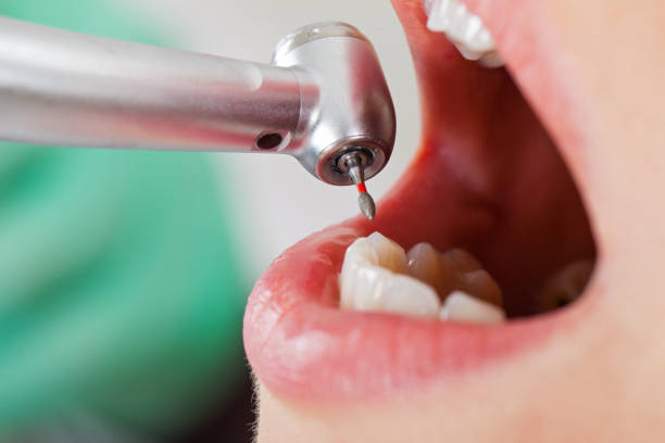 Best Emergency Treatment for Oral Infections in Porterville, CA